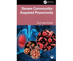 KNYGA Bookshop Severe Community Acquired Pneumonia