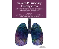 KNYGA Bookshop Severe Pulmonary Emphysema: