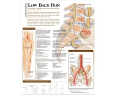 KNYGA Bookshop Understanding Low Back Pain Anatomical Chart