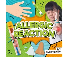 KNYGA Charis Mather; Jasmine Pointer Allergic Reaction