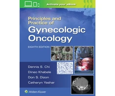 KNYGA Dennis Chi Principles and Practice of Gynecologic Oncology