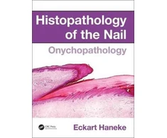 KNYGA Eckart Haneke Histopathology of the Nail