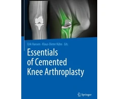 KNYGA Erik Hansen Essentials of Cemented Knee Arthroplasty