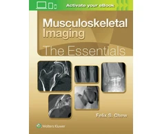 KNYGA Felix S. Chew MD Musculoskeletal Imaging: The Essentials