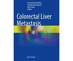 KNYGA Jean Nicolas Vauthey Colorectal Liver Metastasis