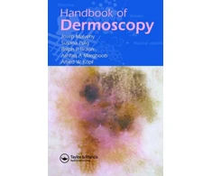 KNYGA Josep Malvehy Handbook of Dermoscopy