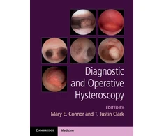 KNYGA Mary Connor Diagnostic and Operative Hysteroscopy