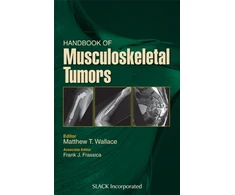 KNYGA Matthew T Wallace Handbook of Musculoskeletal Tumors