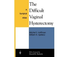 KNYGA Mitchel S Hoffman Difficult Vaginal Hysterectomy