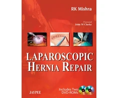 KNYGA R K Mishra Laparoscopic Hernia Repair