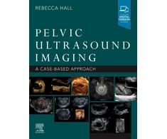 KNYGA Rebecca Hall Pelvic Ultrasound Imaging
