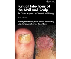 KNYGA Robert Baran Fungal Infections of the Nail and Scalp