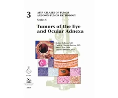 KNYGA Robert Folberg Tumors of the Eye and Ocular Adnexa