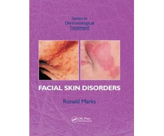 KNYGA Ronald Marks Facial Skin Disorders