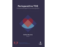 KNYGA Stefaan Bouchez Perioperative TOE