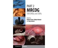 KNYGA Andrew Sizer Part 2 MRCOG: 500 EMQs and SBAs