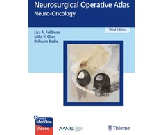 KNYGA Behnam Badie Neurosurgical Operative Atlas: Neuro-Oncology