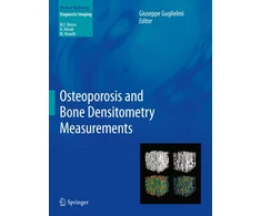 KNYGA Bookshop Osteoporosis and Bone Densitometry Measurements
