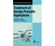 KNYGA Bookshop Treatment of Benign Prostatic Hyperplasia
