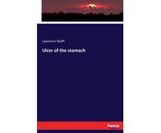 KNYGA Bookshop Ulcer of the stomach