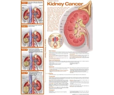 KNYGA Bookshop Understanding Kidney Cancer Anatomical Chart