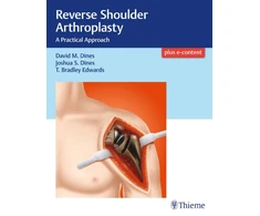 KNYGA David M Dines Reverse Shoulder Arthroplasty