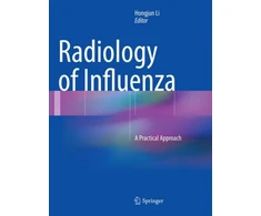 KNYGA Hongjun Li Radiology of Influenza