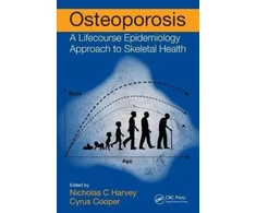KNYGA Nicholas Harvey Osteoporosis