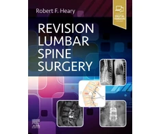 KNYGA Robert F Heary Revision Lumbar Spine Surgery