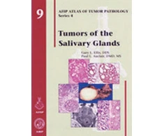 KNYGA Robert J Kruman Tumors of the Salivary Glands