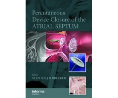 KNYGA Stephen Jd Brecker Percutaneous Device Closure of the Atrial Septum