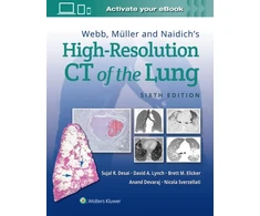 KNYGA Sujal Desai Webb, Muller and Naidich's High-Resolution CT of the Lung