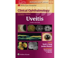 KNYGA Sunir J Garg Uveitis