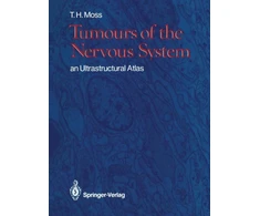 KNYGA T. H. Moss MB Tumours of the Nervous System