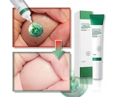 Anti-aknė poras mažinantis gelis veido odos priežiūrai 20ml