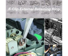 Cersaty® E-clip fiksavimo žiedų rinkinys 1.5/2/3/4/5/6/7/8/9/10 mm, fiksavimo poveržlių asortimentas guolių ir skriemulių tvirtinimui, 200 vnt.