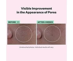 "Strivectin Multi Action Super Poras mažinantis serumas" 30ml