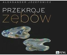 PZWL dantų skerspjūviai