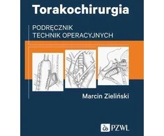 PZWL krūtinės ląstos chirurgija