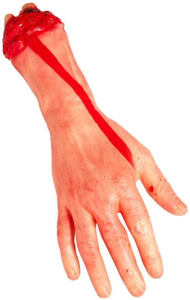 Widmann Nukirsta žmogaus ranka trumpa