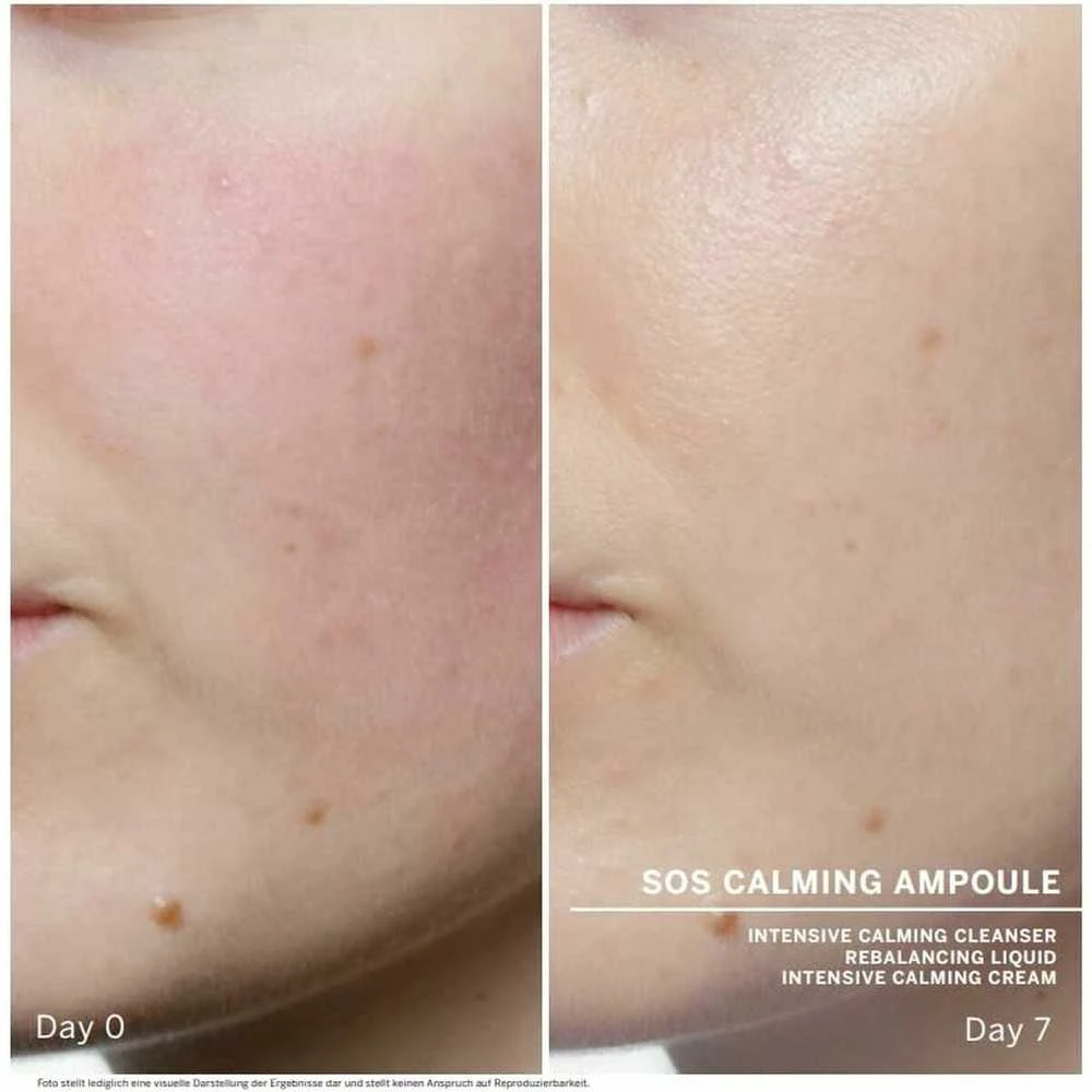 Babor SOS Calming Ampoule Concentrates raminančios ampulės veidui, 7 x 2 ml