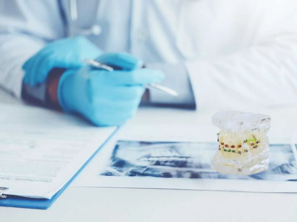 Stomatologinis dantų modelis su ortodontiniu prietaisu