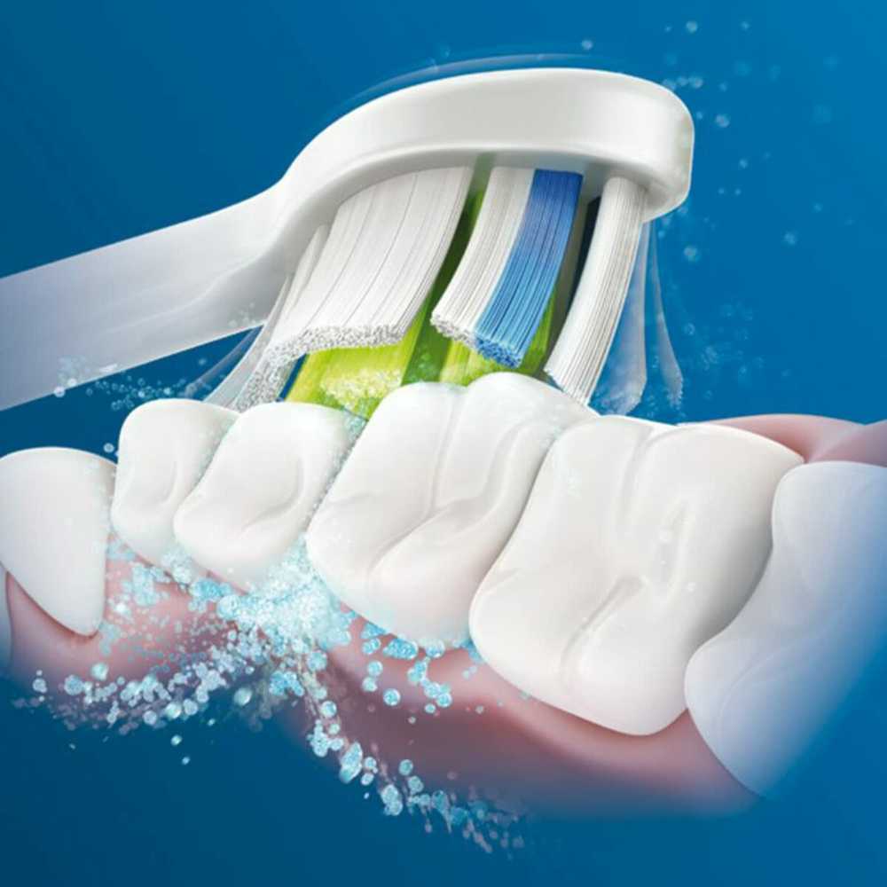 Philips Sonicare ProtectiveClean 6100 Sonic elektrinis dantų šepetėlis HX6877/28