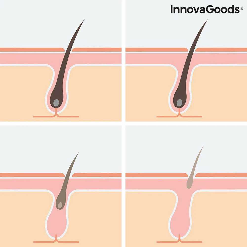 Intensyvus impulsinių šviesų plaukų šalintojas su priedais Ipylator InnovaGoods (Naudoti A)