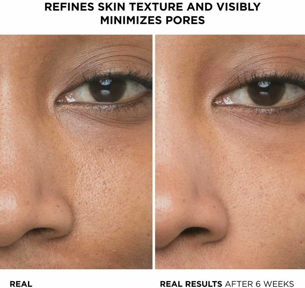 IT Cosmetics Bye Bye Pores Concentrated Derma Serum koncentruotas poras mažinantis serumas veidui, 30 ml