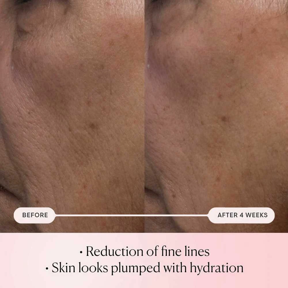 „Elemis Pro-Collagen“ rožių mikro serumas, 30 ml