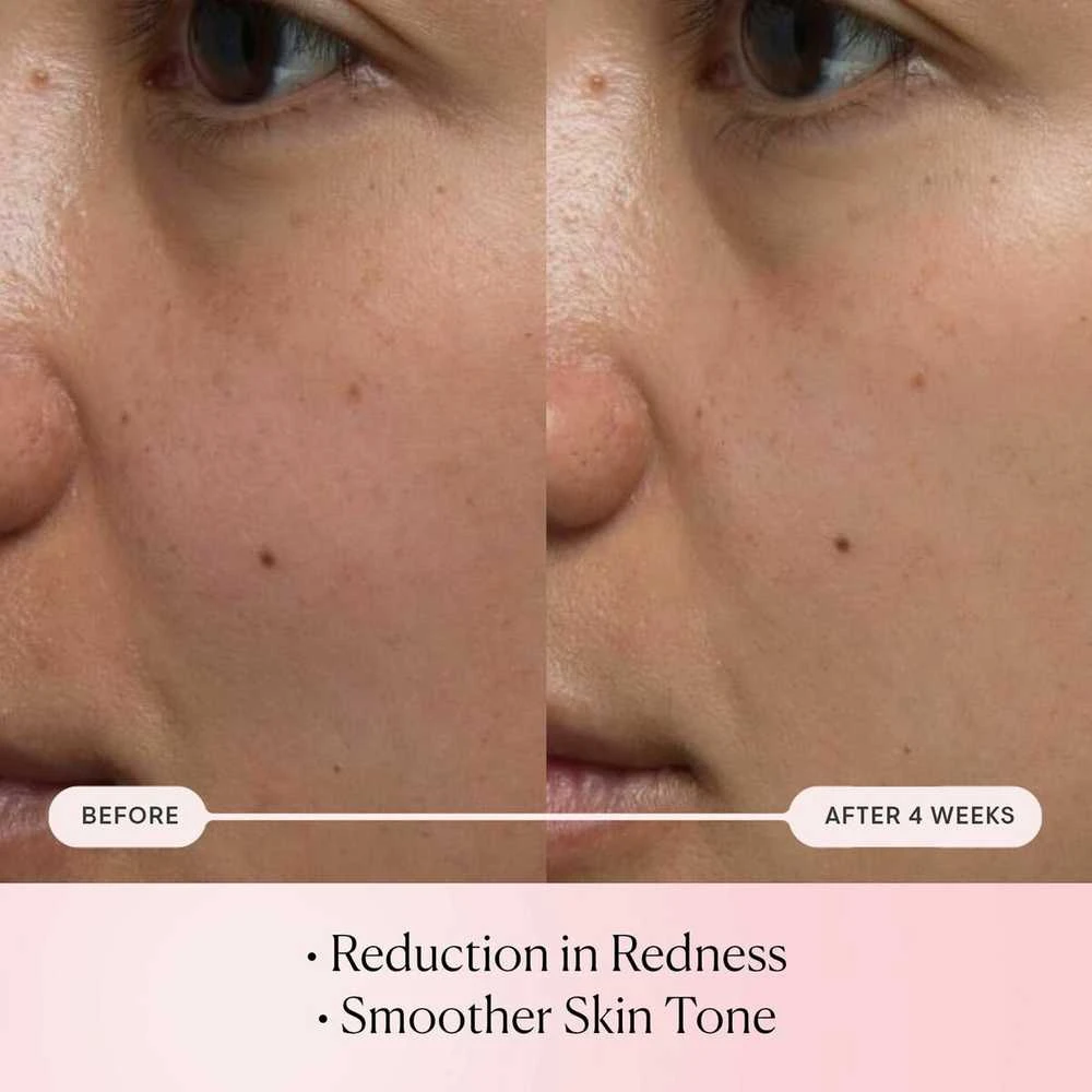 „Elemis Pro-Collagen“ rožių mikro serumas, 30 ml