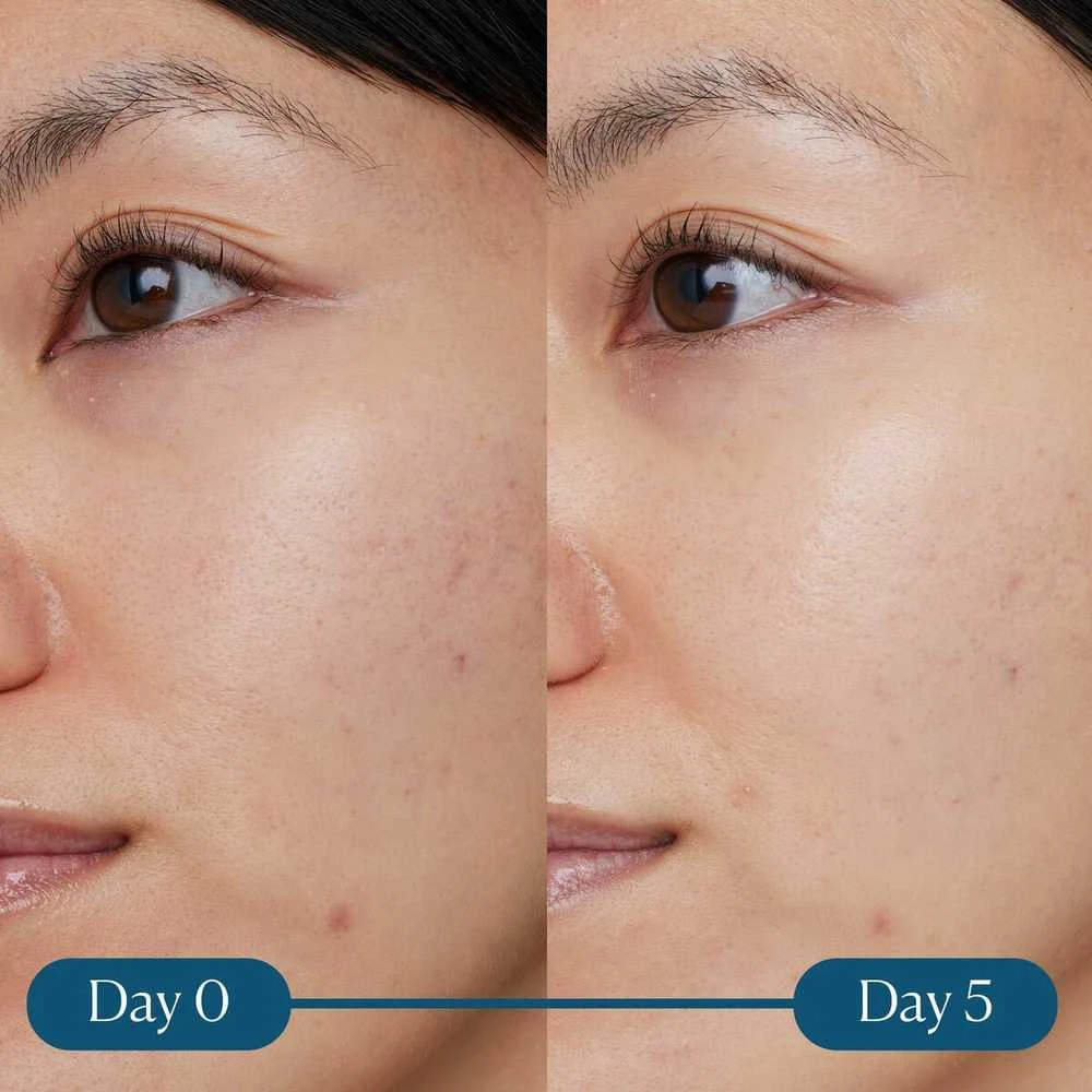 „Elemis Dynamic Resurfacing Super-C“ serumas, 30 ml