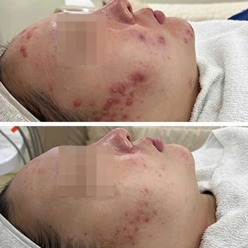 ByTheQuality antioksidacinis kremas TocoMax 20