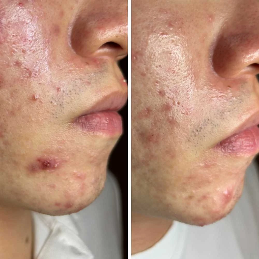 ByTheQuality veido serumas su pieno rūgštimi ir probiotikais LactZe Serum